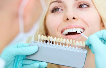 Hollywood smile