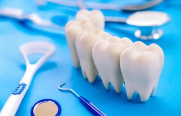 Teeth implant