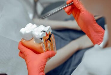 Cosmetic fillings