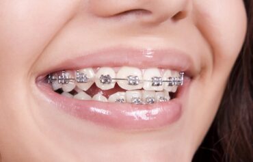 orthodontics