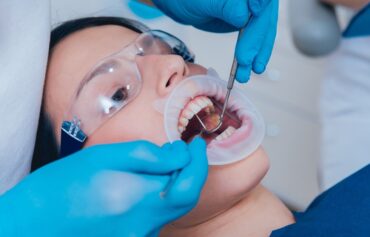 Dental treatments