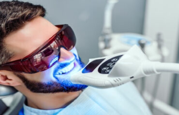 Teeth whitening