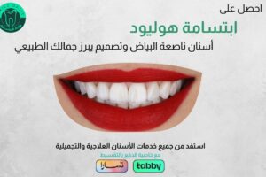 عروض ابتسامة هوليود