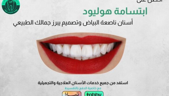 عروض ابتسامة هوليود