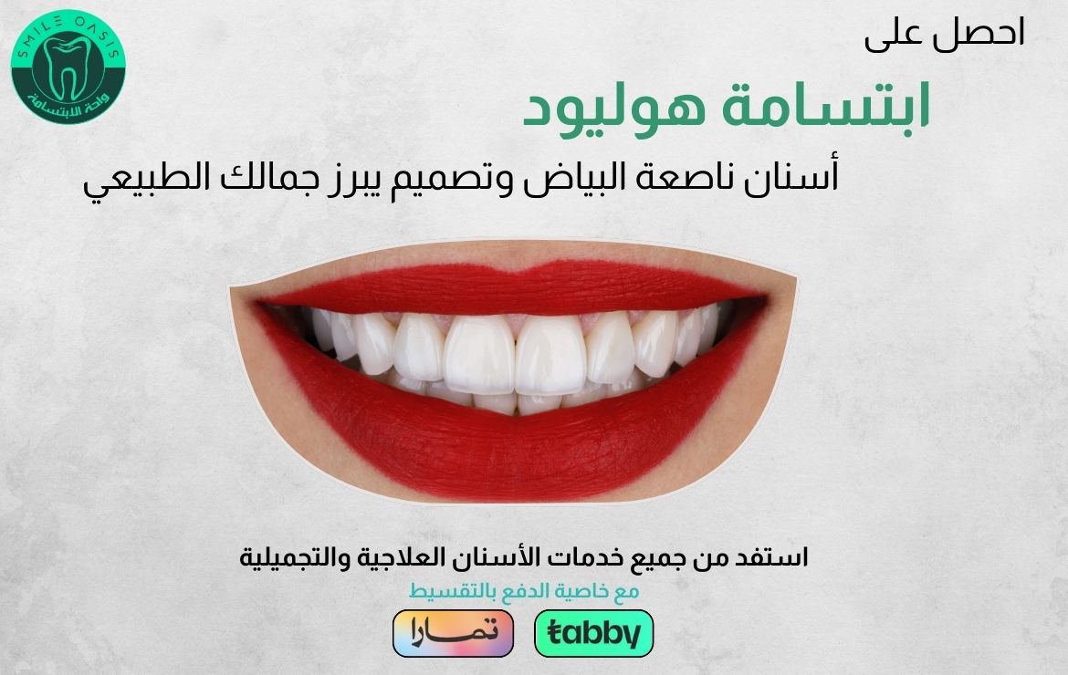 عروض ابتسامة هوليود