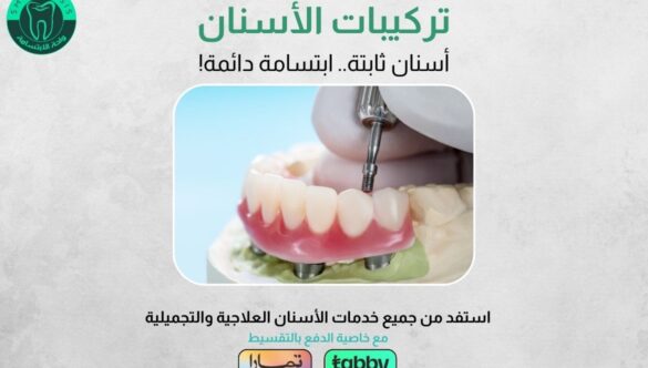 عروض تركيبات الأسنان