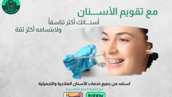 عروض تقويم الأسنان