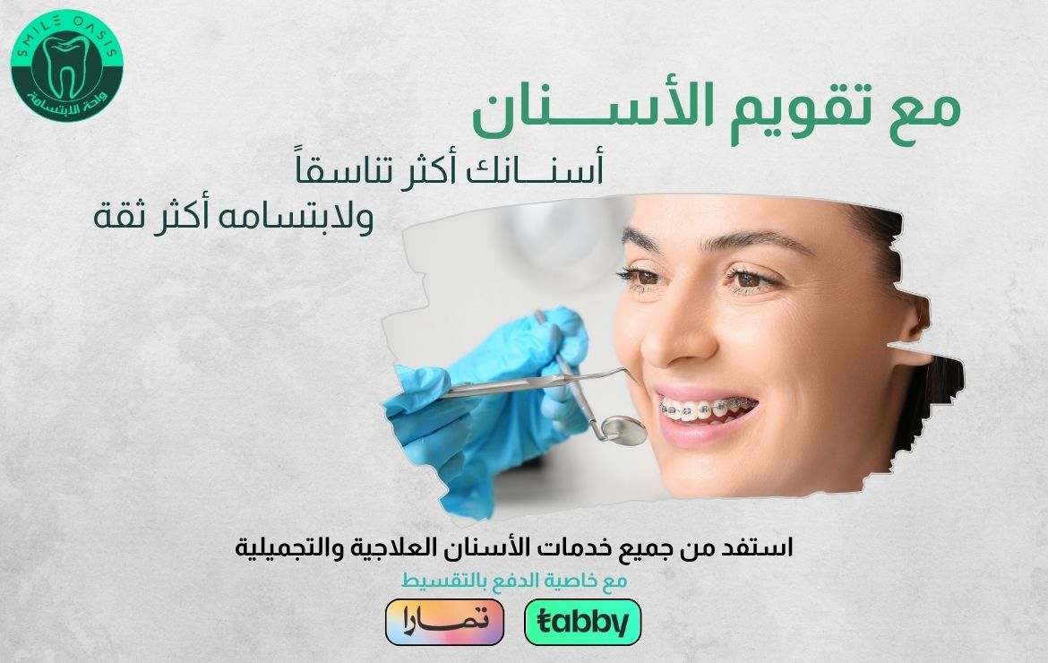 عروض تقويم الأسنان